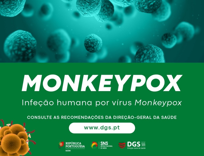 Monkeypox DGS