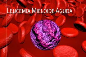 21 de Abril: Dia Mundial de Sensibilização para a Leucemia Mieloide Aguda (LMA)